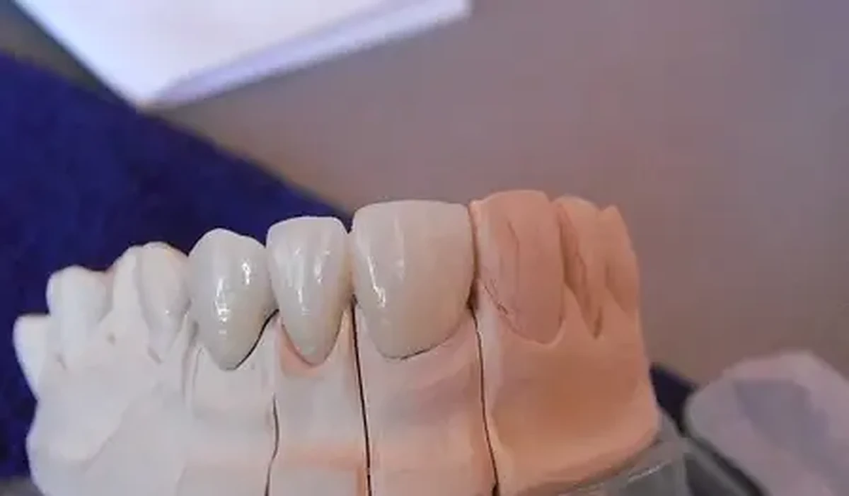 Contact Laborator Dentar CDL pentru colaborari cu medici si clinici