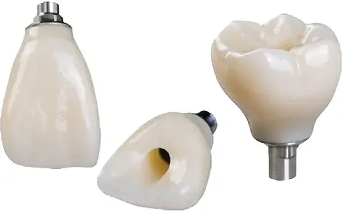 Lucrari protetice pe implanturi realizate de Laborator Dentar CDL